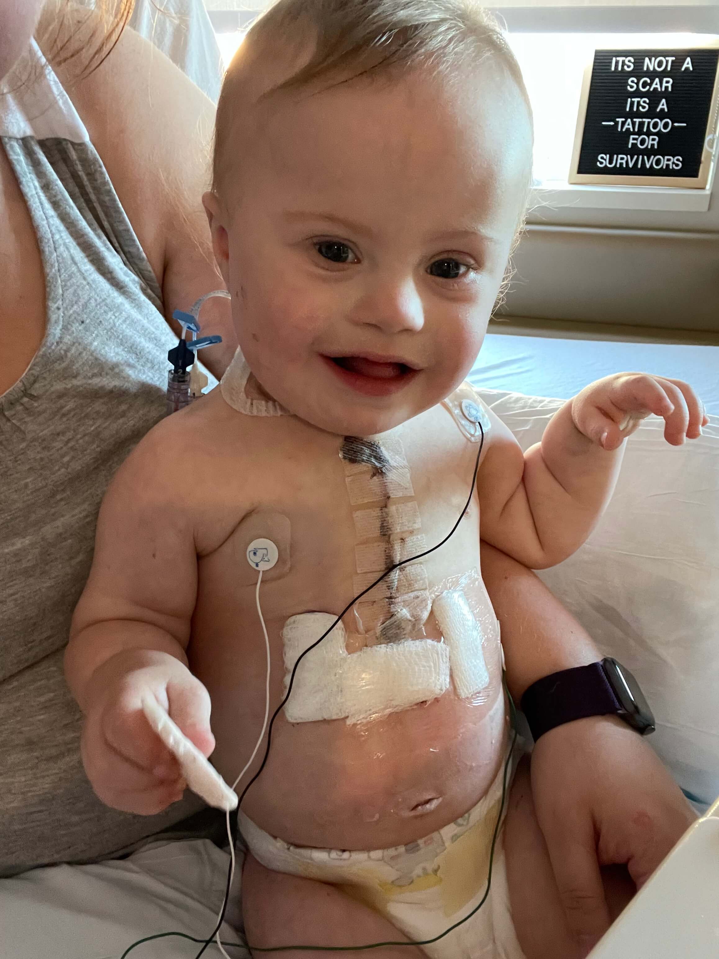 Isaac heart surgery pre cancer diagnosis